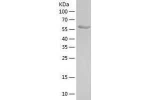 Western Blotting (WB) image for Karyopherin alpha 5 (Importin alpha 6) (KPNA5) (AA 1-536) protein (His tag) (ABIN7123666) (KPNA5 Protein (AA 1-536) (His tag))
