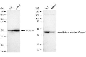 Western blotting analysis using Histone acetyltransferase 1 antibody (ABIN7798921).