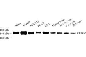 Western blot analysis of CEBPZ (ABIN7073360) at dilution of 1: 500 (CEBPZ 抗体)
