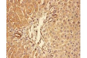 IHC-P: C5a antibody testing of rat liver tissue (C5A 抗体  (N-Term))