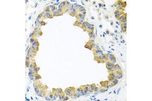 Immunohistochemistry of paraffin-embedded mouse lung using WNT5B antibody. (WNT5B 抗体  (AA 120-359))