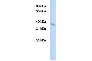 TMEM82 antibody used at 1 ug/ml to detect target protein. (TMEM82 抗体  (N-Term))