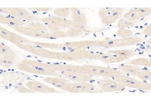 Detection of TNFb in Human Cardiac Muscle Tissue using Monoclonal Antibody to Tumor Necrosis Factor Beta (TNFb) (LTA 抗体  (AA 36-205))