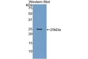 Detection of Recombinant CRP, Porcine using Polyclonal Antibody to C Reactive Protein (CRP) (CRP 抗体  (AA 20-222))