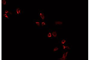 ABIN6269209 staining PC-3 cells by IF/ICC. (NOS1 抗体  (Internal Region))