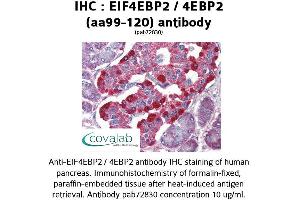 Image no. 1 for anti-Eukaryotic Translation Initiation Factor 4E Binding Protein 2 (EIF4EBP2) (AA 99-120) antibody (ABIN1733956) (eIF4EBP2 抗体  (AA 99-120))