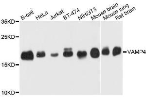 Western blot analysis of extracts of various cell lines, using VAMP4 antibody. (VAMP4 抗体  (AA 1-115))