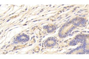 Immunohistochemistry (IHC) image for anti-serine Peptidase Inhibitor, Kazal Type 5 (SPINK5) (AA 699-976) antibody (ABIN7436423)