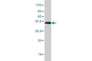 Western Blot detection against Immunogen (35. (RORB 抗体  (AA 136-224))