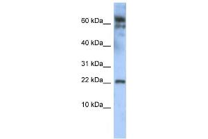 Western Blotting (WB) image for anti-Leucine Zipper, Down-Regulated in Cancer 1 (LDOC1) antibody (ABIN2458354) (LDOC1 抗体)