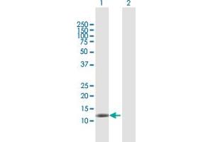 Western Blot analysis of DAAM2 expression in transfected 293T cell line by DAAM2 MaxPab polyclonal antibody. (DAAM2 抗体  (AA 1-132))