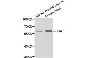 Western blot analysis of extracts of various cell lines, using CRAT antibody.