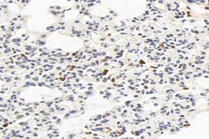 Immunohistochemistry analysis of paraffin-embedded mouse lung using,Factor XIIIa (ABIN7073528) at dilution of 1: 2400 (F13A1 抗体)