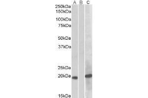 HEK293 lysate (10ug protein in RIPA buffer) overexpressing Human HOXA1 (RC222721) with C-terminal MYC tag probed with ABIN571120 (1ug/ml) in Lane A and probed with anti-MYC Tag (1/1000) in lane C. (HOXA1 抗体  (Internal Region))