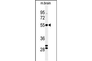 Western blot analysis of FA2H Antibody in mouse brain tissue lysates (35ug/lane) (FA2H 抗体  (AA 121-148))