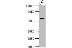 Western Blot Positive WB detected in: U87 whole cell lysate All lanes: PRAMEF17 antibody at 1:2000 Secondary Goat polyclonal to rabbit IgG at 1/50000 dilution Predicted band size: 55 kDa Observed band size: 55 kDa (PRAMEF17 抗体  (AA 69-259))