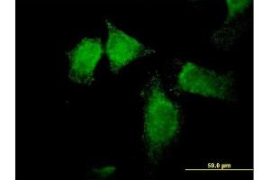 Immunofluorescence of purified MaxPab antibody to SNX13 on HeLa cell. (SNX13 抗体  (AA 1-957))