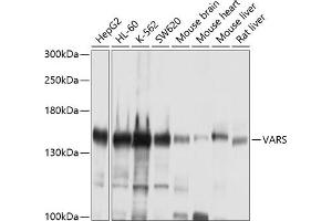 Western blot analysis of extracts of various cell lines, using VARS antibody (ABIN1683239, ABIN3018665, ABIN3018666 and ABIN6220533) at 1:1000 dilution. (VARS 抗体  (AA 1-280))
