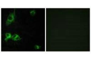 Immunofluorescence analysis of COS-7 cells, using LAMA1 antibody. (Laminin alpha 1 抗体)