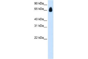 WB Suggested Anti-TRIM32 Antibody Titration:  1. (TRIM32 抗体  (C-Term))