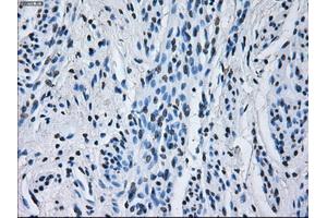 Immunohistochemical staining of paraffin-embedded Kidney tissue using anti-RNF144Bmouse monoclonal antibody. (RNF144B 抗体  (AA 1-256))