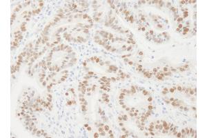 Immunohistochemistry (IHC) image for anti-Proliferating Cell Nuclear Antigen (PCNA) (AA 75-125) antibody (ABIN7454604)