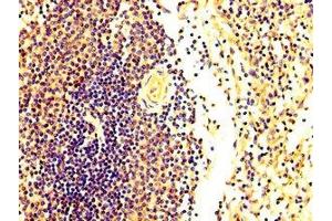 IHC image of ABIN7152598 diluted at 1:300 and staining in paraffin-embedded human spleen tissue performed on a Leica BondTM system. (FASTKD2 抗体  (AA 117-203))