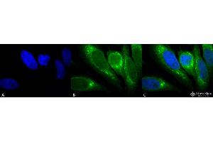 Immunocytochemistry/Immunofluorescence analysis using Mouse Anti-GRP78 Monoclonal Antibody, Clone 1H11-1H7 . (GRP78 抗体  (HRP))