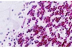 Human Brain, Cerebellum: Formalin-Fixed, Paraffin-Embedded (FFPE) (PDX1 抗体  (AA 27-76))