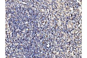 IHC analysis of Kinectin 1/KTN1 using anti-Kinectin 1/KTN1 antibody (ABIN7601096).