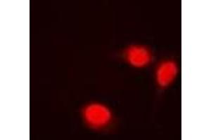 Immunofluorescent analysis of Transketolase staining in Jurkat cells. (TKT 抗体)