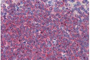Human Spleen: Formalin-Fixed, Paraffin-Embedded (FFPE) (ALDH5A1 抗体  (C-Term))