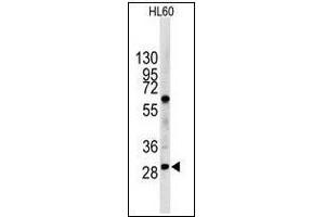 Western blot analysis of LIN28B in HL60 cell line lysates (35 µg/lane).