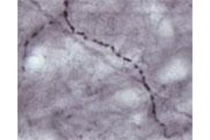 IHC on rat brain (free floating sections) using Rabbit antibody to VGluT1  at a concentration of 30 µg/ml.