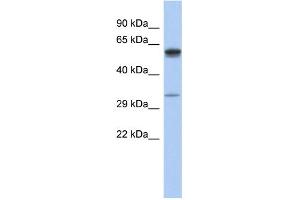 WB Suggested Anti-ZDHHC24 Antibody Titration: 0. (ZDHHC24 抗体  (Middle Region))