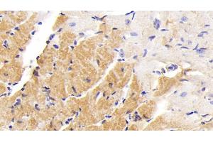 Detection of PIIINP in Mouse Cardiac Muscle Tissue using Polyclonal Antibody to Procollagen III N-Terminal Propeptide (PIIINP)