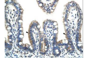 Image no. 1 for anti-BTB (POZ) Domain Containing 6 (BTBD6) (AA 87-136) antibody (ABIN202456) (BTBD6 抗体  (AA 87-136))