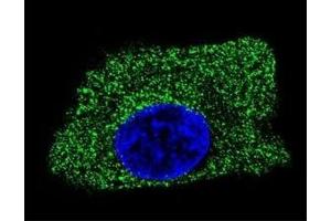 Confocal immunofluorescent analysis of LAMP2 antibody with HepG2 cells followed by Alexa Fluor 488-conjugated goat anti-mouse lgG (green). (LAMP2 抗体)