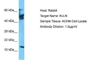 Host: Rabbit Target Name: KLLN Sample Tissue: Human ACHN Whole Cell Antibody Dilution: 1ug/ml (KLLN 抗体  (Middle Region))