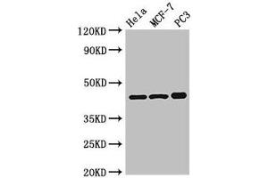 PRKAR2A 抗体  (Regulatory Subunit)