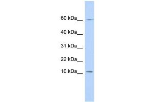 WB Suggested Anti-PI3 Antibody Titration:  0. (PI3 抗体  (N-Term))