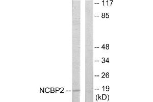 Western blot analysis of extracts from COLO205 cells, using NCBP2 antibody. (NCBP2 抗体  (N-Term))