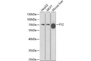 Western blot analysis of extracts of various cell lines using F12 Polyclonal Antibody at dilution of 1:1000. (F12 抗体)