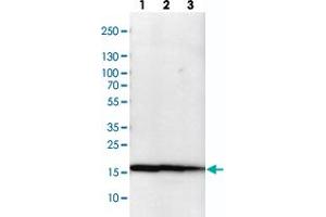 Western blot analysis of cell lysates with NME1-NME2 polyclonal antibody  at 1:100-1:500 dilution. (NME1 抗体)