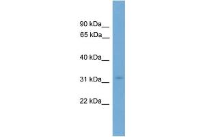 WB Suggested Anti-KRCC1  Antibody Titration: 0. (KRCC1 抗体  (N-Term))