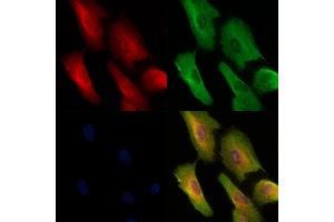 Phospho-RIP3 (Thr187) Antibody staining A549 cells(H2O2 treatment) by IF/ICC. (MPRIP 抗体  (pThr187))