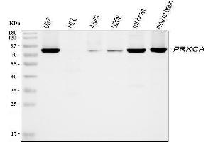 Western blot analysis of PKC alpha using anti-PKC alpha antibody (ABIN3043549).