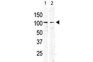 cKit antibody used in western blot to detect KIT in serum-starved HeLa cell lysate (lane 1) and primate testis tissue lysate (2). (KIT 抗体  (AA 9-40))