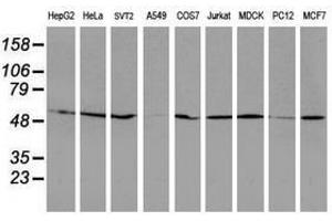 Image no. 8 for anti-RuvB-Like 2 (E. Coli) (RUVBL2) (AA 113-370) antibody (ABIN1490850)
