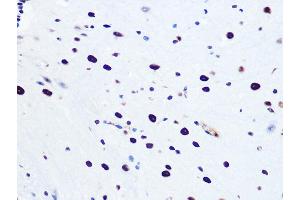 Immunohistochemistry of paraffin-embedded mouse spinal cord using DHX9/DHX9/RNA Helicase A Rabbit mAb (ABIN7265747) at dilution of 1:100 (40x lens). (DHX9 抗体)